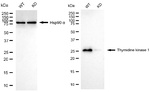 TK1 Antibody in Western Blot (WB)