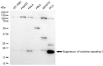 SOCS2 Antibody in Western Blot (WB)