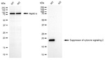 SOCS2 Antibody in Western Blot (WB)