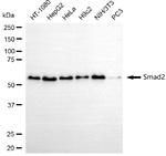 SMAD2 Antibody in Western Blot (WB)
