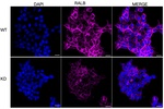 RALB Antibody in Immunocytochemistry (ICC/IF)