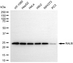 RALB Antibody in Western Blot (WB)