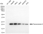 PRDX2 Antibody in Western Blot (WB)
