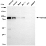 PLOD2 Monoclonal Antibody (25GB5800)