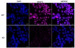 NR2F2 Antibody in Immunocytochemistry (ICC/IF)