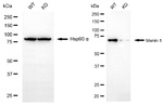Menin Antibody in Western Blot (WB)