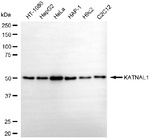 KATNAL1 Antibody in Western Blot (WB)