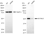 KATNAL1 Antibody in Western Blot (WB)
