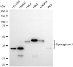 Dystroglycan Recombinant Rabbit Monoclonal Antibody (25GB4100)