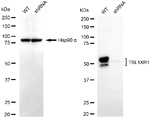 TBLR1 Antibody in Western Blot (WB)