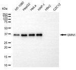 SMN1 Antibody in Western Blot (WB)