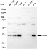 SMN1 Antibody in Western Blot (WB)