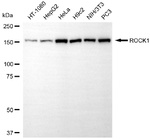 ROCK1 Antibody in Western Blot (WB)