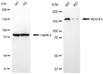 ROCK1 Antibody in Western Blot (WB)