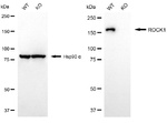 ROCK1 Antibody in Western Blot (WB)
