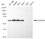 PPP2R1B Monoclonal Antibody (25GB5610)