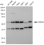 PPM1B Antibody in Western Blot (WB)