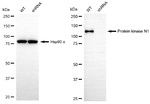 PKN1 Antibody in Western Blot (WB)