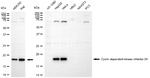 p16INK4a Antibody in Western Blot (WB)
