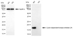 p16INK4a Antibody in Western Blot (WB)