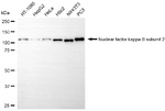 NFkB p52/p100 Antibody in Western Blot (WB)
