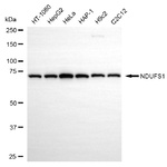 NDUFS1 Antibody in Western Blot (WB)