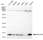 NDUFB2 Antibody in Western Blot (WB)