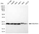 NDUFB10 Antibody in Western Blot (WB)