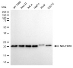 NDUFB10 Antibody in Western Blot (WB)