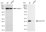 NDUFB10 Antibody in Western Blot (WB)