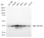 MAPRE2 Monoclonal Antibody (24GB13965)