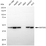 MAPRE2 Antibody in Western Blot (WB)