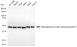 hnRNP F Antibody in Western Blot (WB)