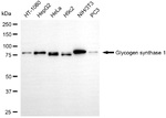 GYS1 Recombinant Rabbit Monoclonal Antibody (25GB2105)