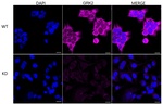 GRK2 Antibody in Immunocytochemistry (ICC/IF)