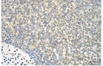 GRK2 Antibody in Immunohistochemistry (Paraffin) (IHC (P))