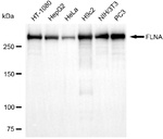 Filamin A Recombinant Rabbit Monoclonal Antibody (25GB2375)