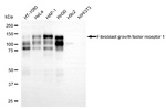 FGFR1 Antibody in Western Blot (WB)