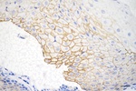 Desmocollin 3 Antibody in Immunohistochemistry (Paraffin) (IHC (P))