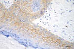 Desmocollin 3 Antibody in Immunohistochemistry (Paraffin) (IHC (P))