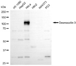 Desmocollin 3 Antibody in Western Blot (WB)