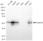 Cytokeratin 8 Antibody in Western Blot (WB)