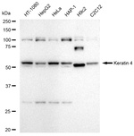 Cytokeratin 4 Antibody in Western Blot (WB)