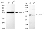 Cytokeratin 4 Antibody in Western Blot (WB)