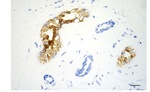 Cytokeratin 18 Antibody in Immunohistochemistry (Paraffin) (IHC (P))