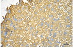 Cytokeratin 18 Antibody in Immunohistochemistry (Paraffin) (IHC (P))