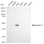Cytokeratin 17 Antibody in Western Blot (WB)