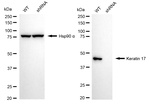 Cytokeratin 17 Antibody in Western Blot (WB)