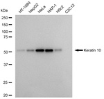 Cytokeratin 10 Recombinant Rabbit Monoclonal Antibody (23GB6105)