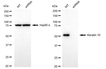 Cytokeratin 10 Antibody in Western Blot (WB)